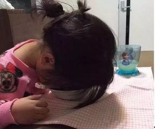 闺蜜吃瓜下巴脱臼视频,视频曝光引网友热议